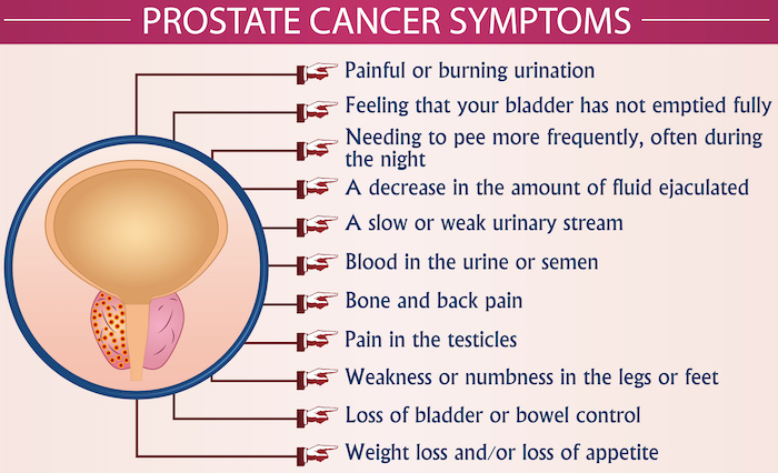 Biden's 2014 Prostate Cancer Screening: What We Know Biden's 2014 Prostate Cancer Screening: What We Know
