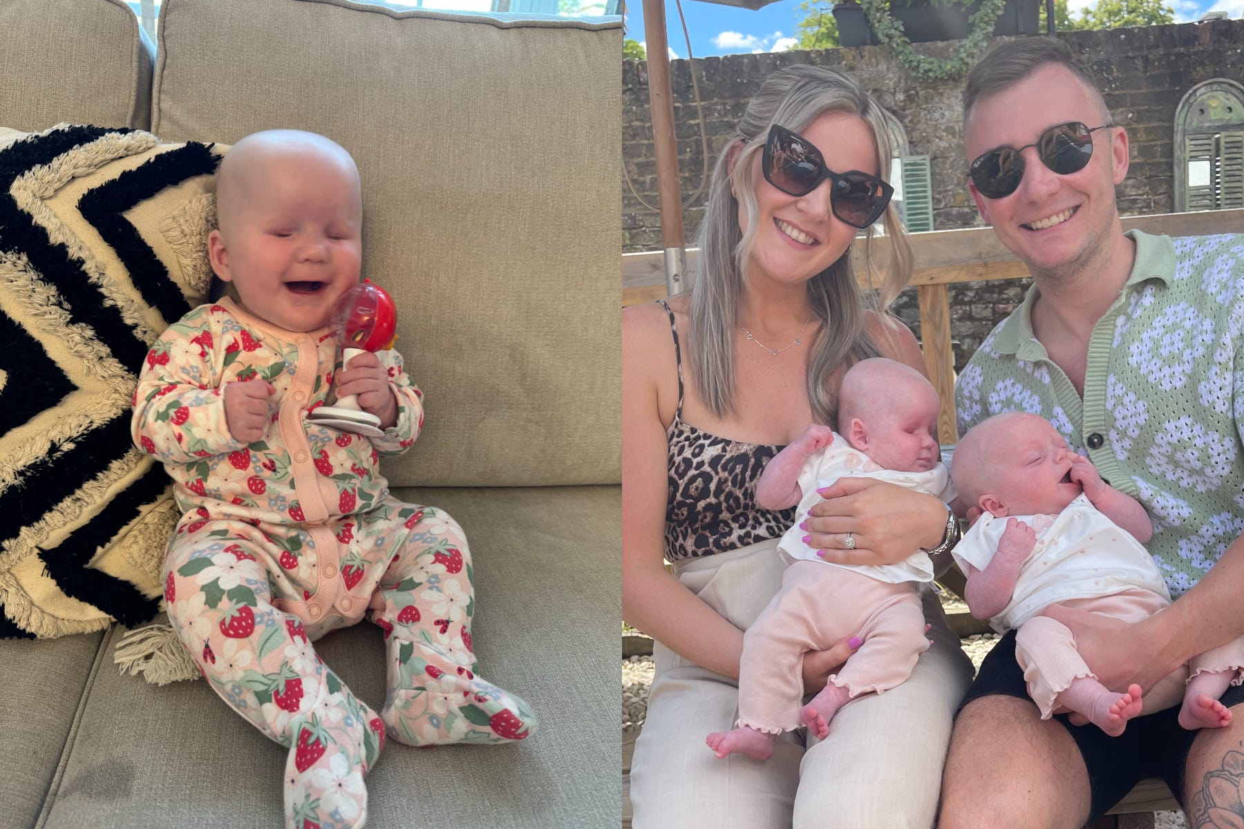 Bilateral Anophthalmia: Understanding The Rare Condition Of Babies Born Without Eyes Bilateral Anophthalmia: Understanding The Rare Condition Of Babies Born Without Eyes