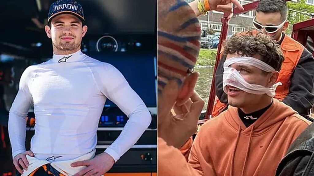 Bizarre Injury Sidelines Formula 1 Driver Lando Norris Bizarre Injury Sidelines Formula 1 Driver Lando Norris