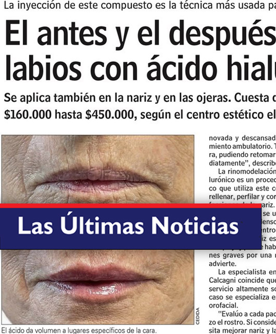 Caída Ticketmaster 8 De Abril: Últimas Noticias Y Actualizaciones Grupo Milenio Caída Ticketmaster 8 De Abril: Últimas Noticias Y Actualizaciones Grupo Milenio