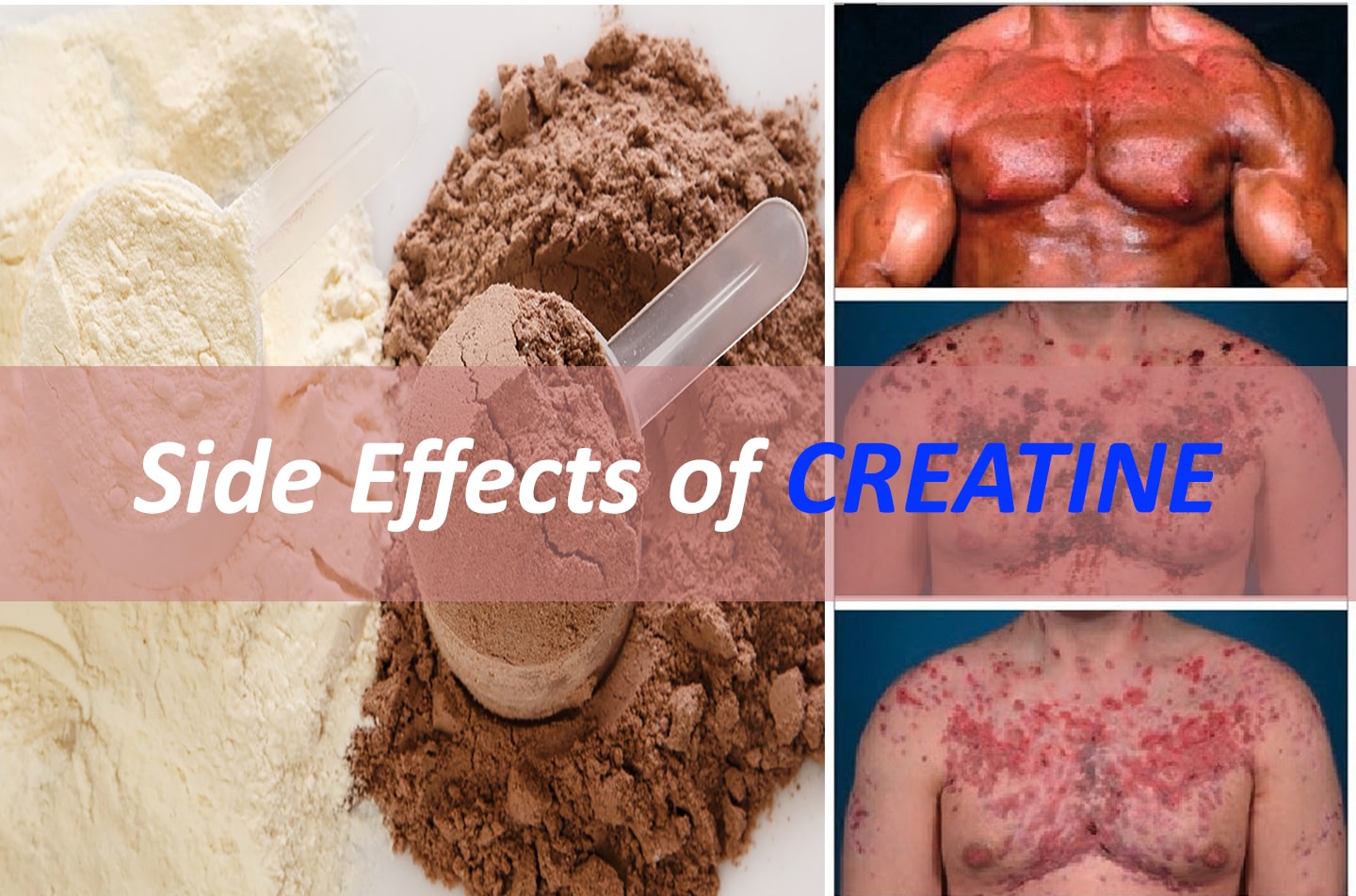 Creatine: Benefits, Side Effects, And Who Should Use It Creatine: Benefits, Side Effects, And Who Should Use It