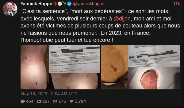 Dijon - Trois Hommes Victimes D'une Agression Brutale Au Lac Kir Dijon - Trois Hommes Victimes D'une Agression Brutale Au Lac Kir