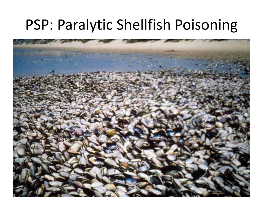 Double Trouble: Harmful Algal Blooms Hit Kodiak Shellfish Harvesting Twice Double Trouble: Harmful Algal Blooms Hit Kodiak Shellfish Harvesting Twice
