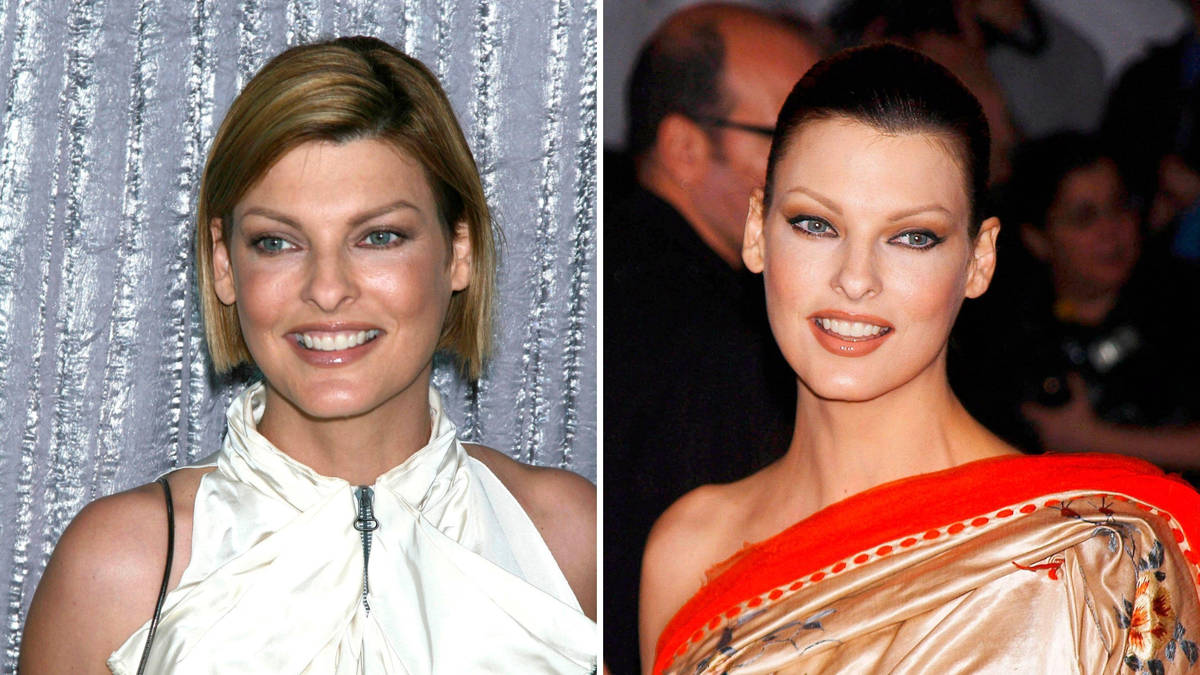 Emotional Recovery After Mastectomy: Lessons From Linda Evangelista Emotional Recovery After Mastectomy: Lessons From Linda Evangelista