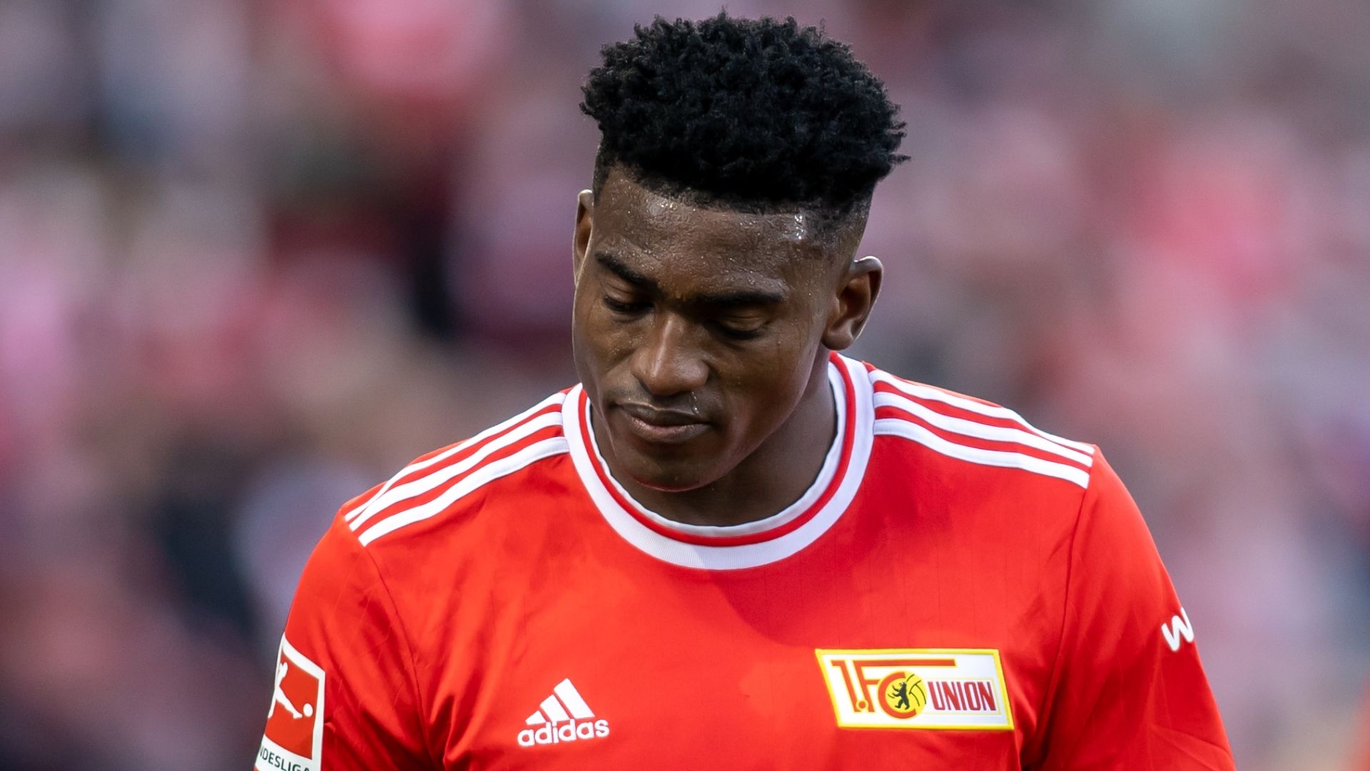 Footballer Awoniyi's Post-Collision Surgery Footballer Awoniyi's Post-Collision Surgery