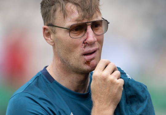 Freddie Flintoff's Recovery: PTSD, Facial Injuries, And His New Role Freddie Flintoff's Recovery: PTSD, Facial Injuries, And His New Role