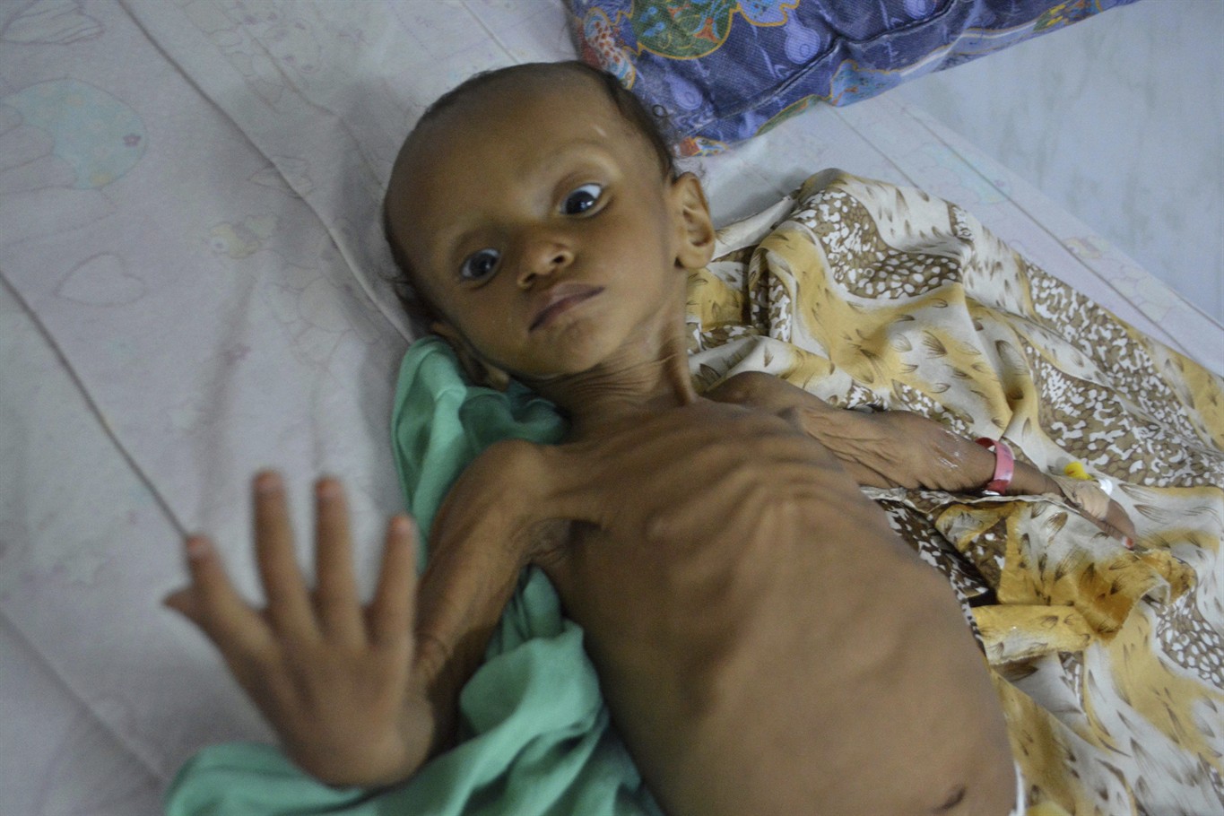 Humanitarian Crisis In Yemen: The Use Of Child Drivers Humanitarian Crisis In Yemen: The Use Of Child Drivers