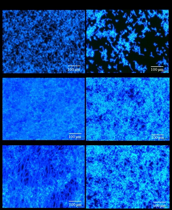 Investigating The Threat Of Climate Change-Fueled Fungal Infections Investigating The Threat Of Climate Change-Fueled Fungal Infections