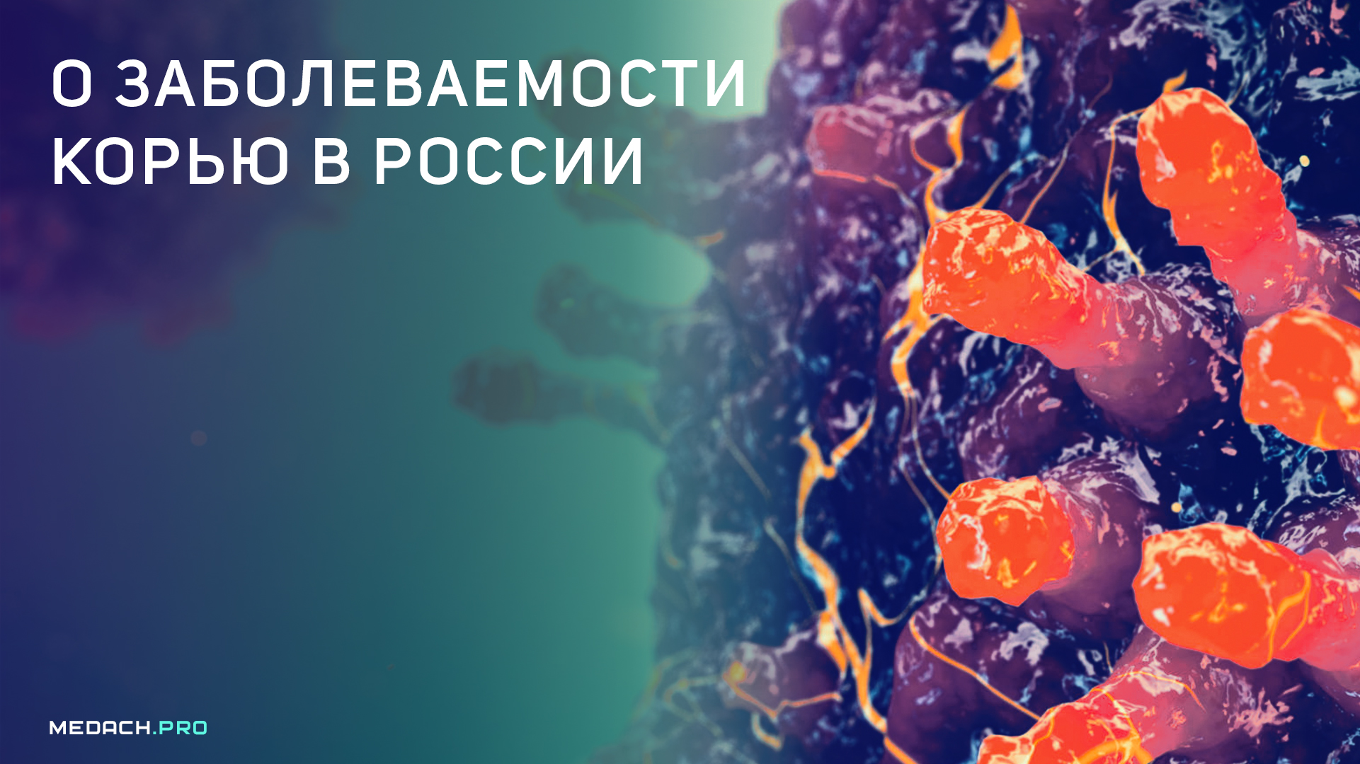 Монголия: Массовый Приток Пациентов С Корью В Больницы Монголия: Массовый Приток Пациентов С Корью В Больницы