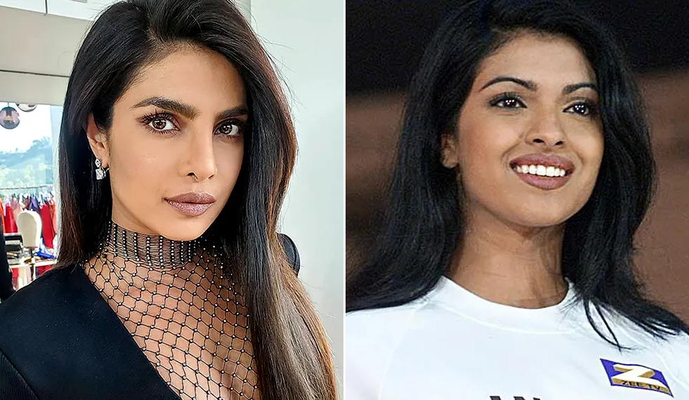 Priyanka Chopra's Botched Nose Job: Her Father's Response