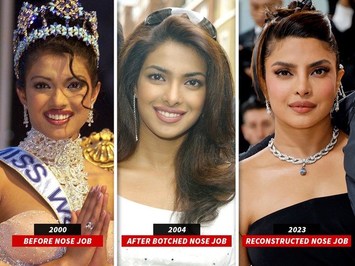 Priyanka Chopra's Nose Surgery: The Untold Story Of Her Father's Reaction Priyanka Chopra's Nose Surgery: The Untold Story Of Her Father's Reaction