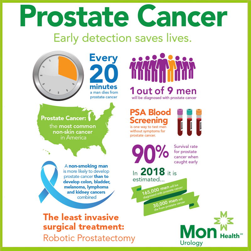 Prostate Cancer Screening: Biden's 2014 Test And Current Status Prostate Cancer Screening: Biden's 2014 Test And Current Status
