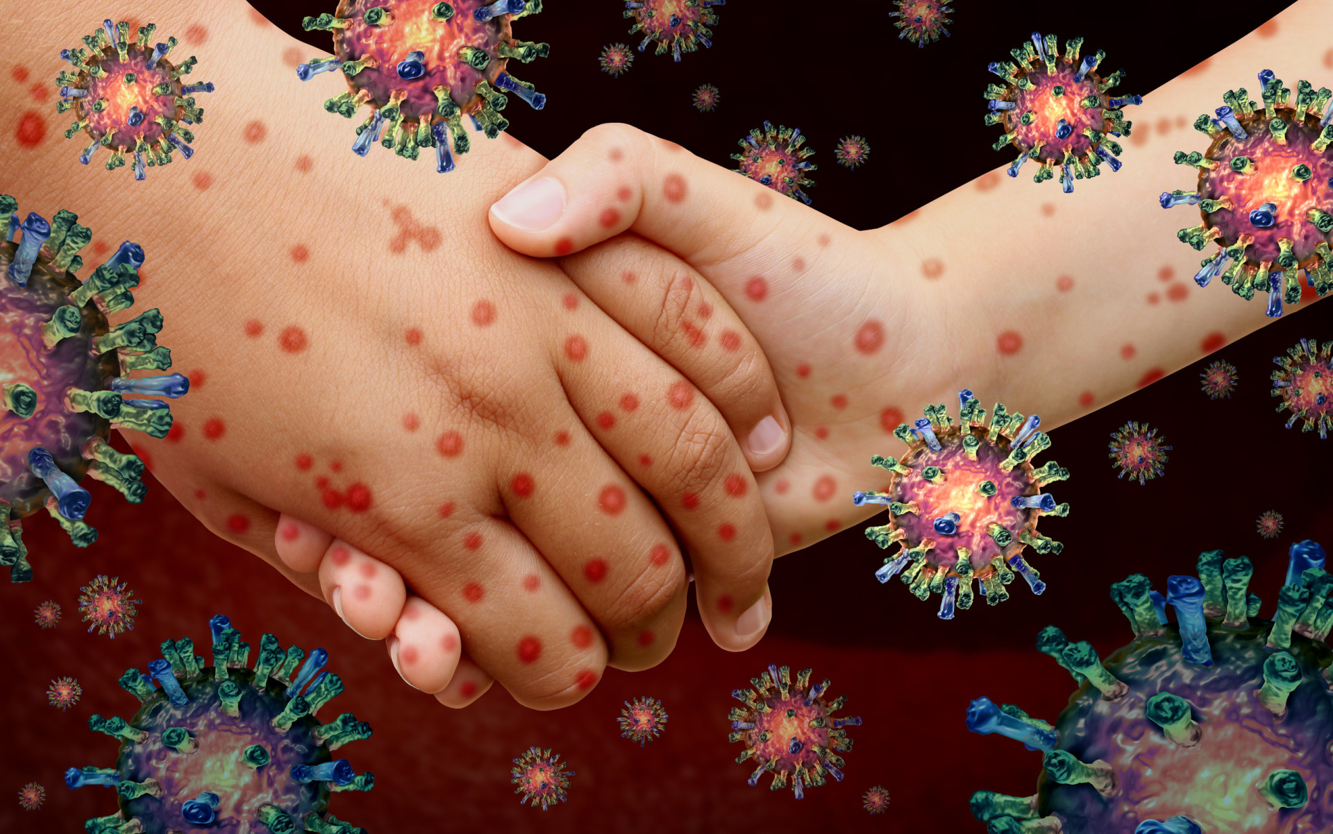 Respiratory Virus Identified As Potential Cause Of Kawasaki Disease Respiratory Virus Identified As Potential Cause Of Kawasaki Disease