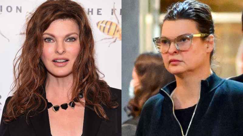 Support System: Linda Evangelista's Experience After Mastectomy Support System: Linda Evangelista's Experience After Mastectomy