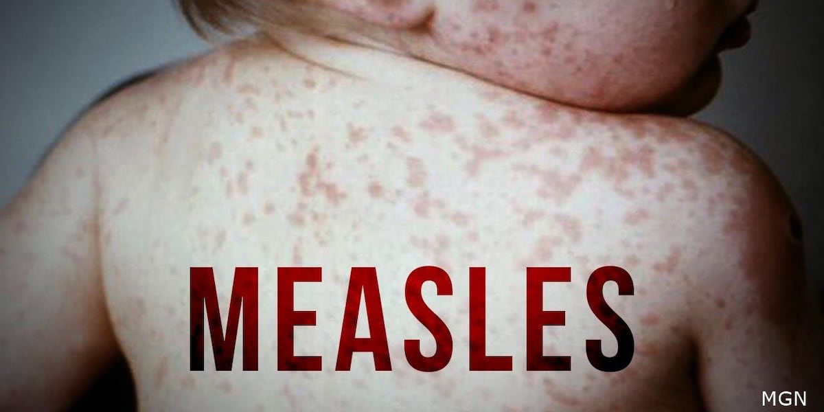 The Resurgence Of Measles: Understanding The Kansas Outbreak The Resurgence Of Measles: Understanding The Kansas Outbreak