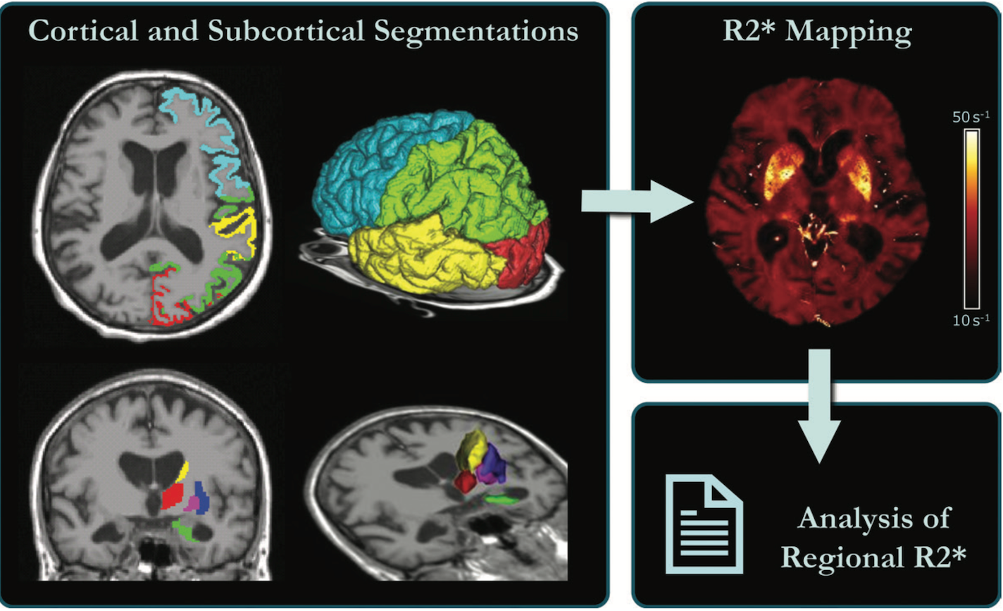 Understanding The Relationship Between ADHD, Aging, And Brain Iron Levels Understanding The Relationship Between ADHD, Aging, And Brain Iron Levels