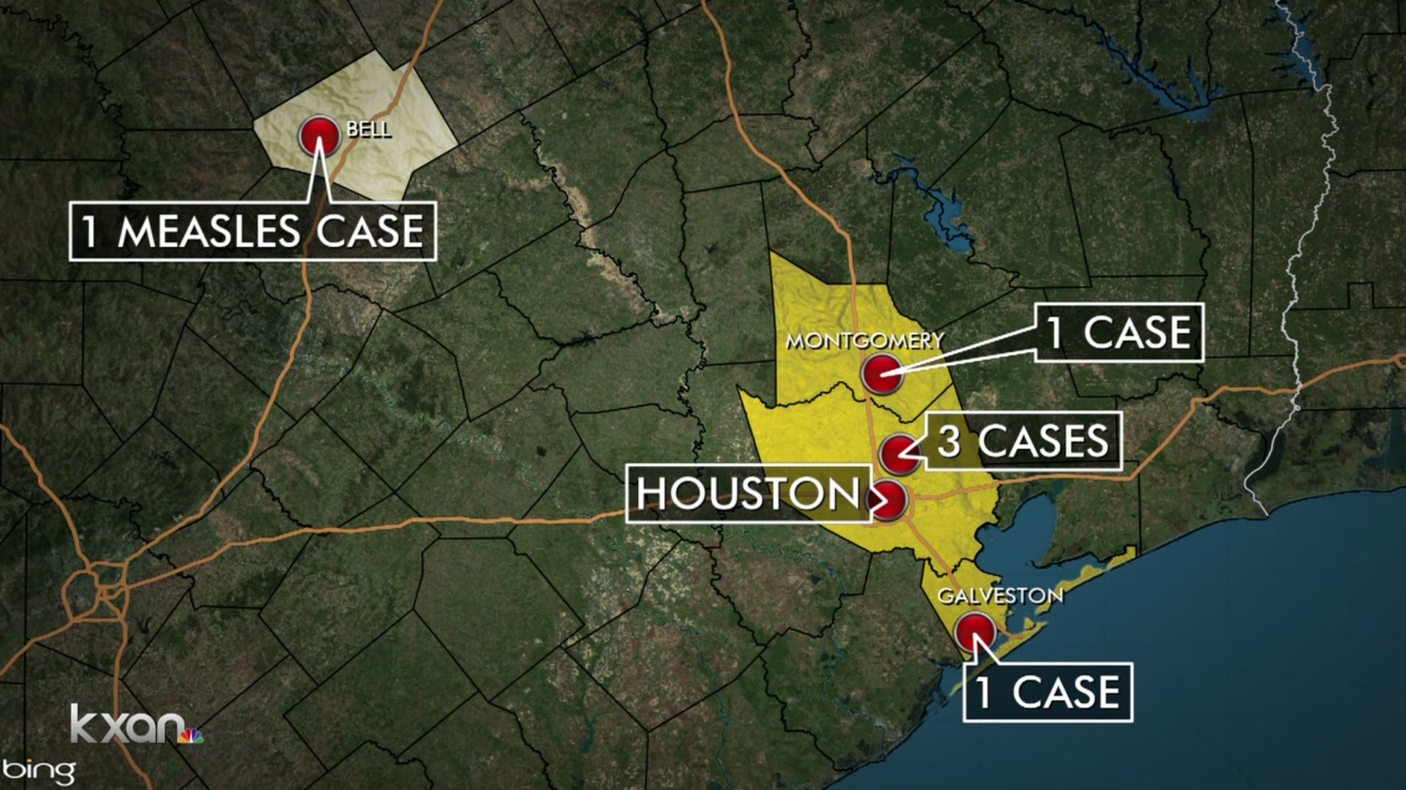 Unrelated Measles Cases On The Rise In Texas Unrelated Measles Cases On The Rise In Texas